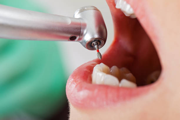 Best Emergency Cosmetic Dentistry (e.g., broken veneers) in Big Spring, TX